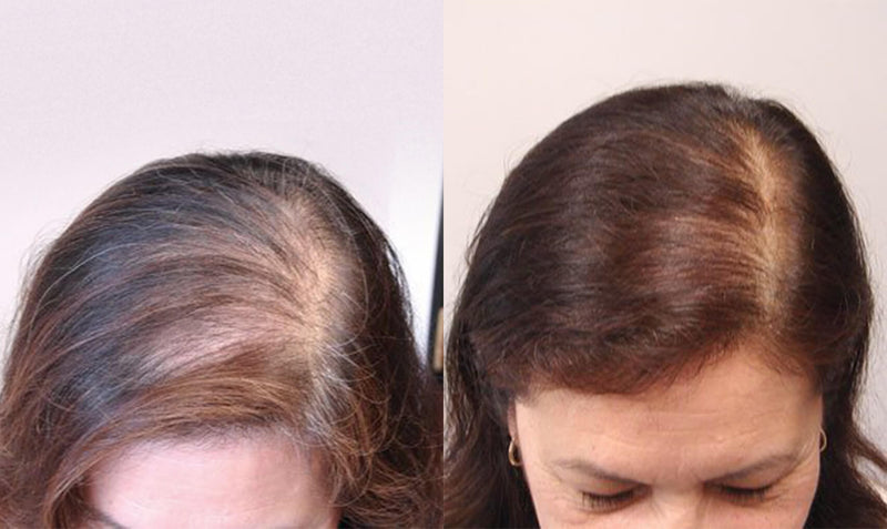 Before and after comparison