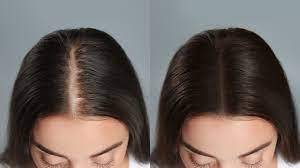 Before and after comparison