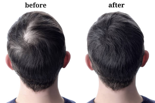 Before and after comparison